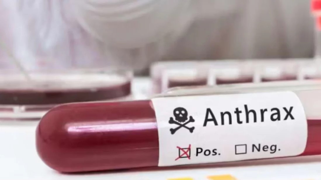 গাইবান্ধায় আরও ৭ জনের শরীরে অ্যানথ্রাক্সের উপসর্গ শনাক্ত